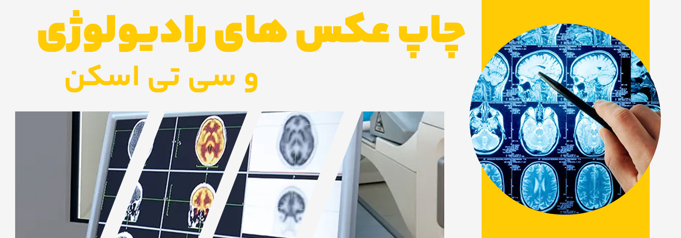 چاپ عکس رادیولوژی در مشهد